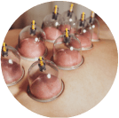 Manual trigger point therapy