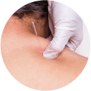 Manual trigger point therapy
